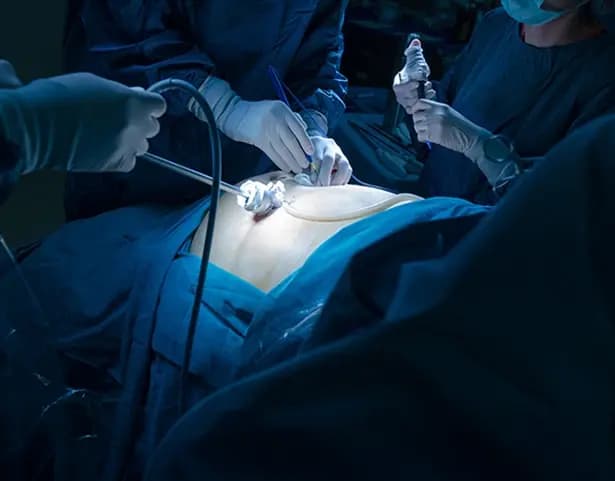 General laparoscopic surgery department image