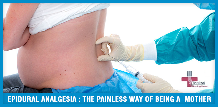 Epidural Analgesia The Painless Way of Being a Mother