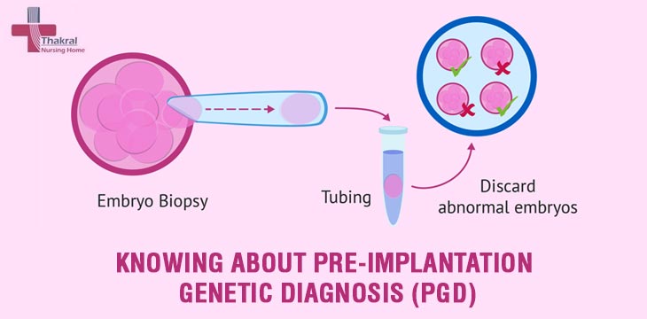 Knowing About Pre-Implantation Genetic Diagnosis