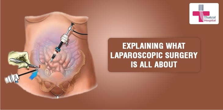 Explaining-what-Laparoscopic-surgery-is-all-about